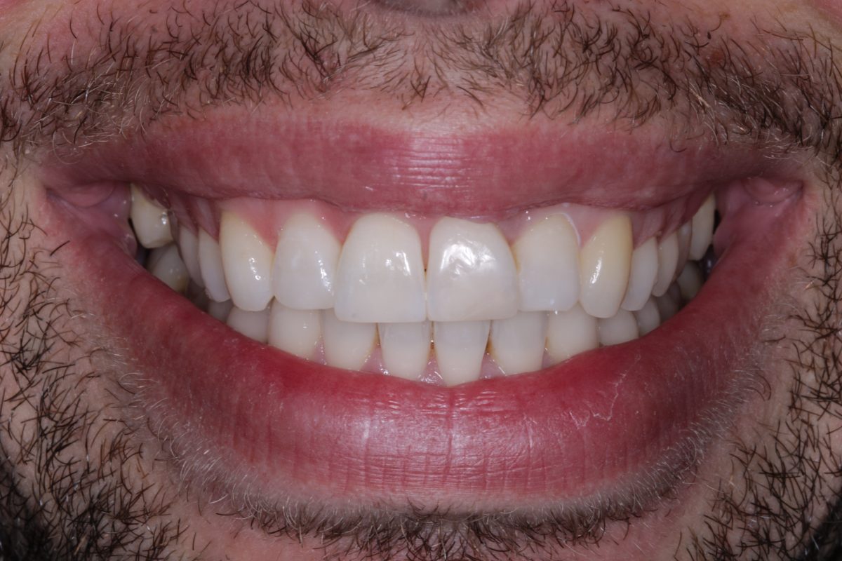6 Common Dental Problems and How to Prevent Them